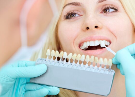 mito-ou-verdade:-veja-os-reais-perigos-de-usar-lentes-dentarias