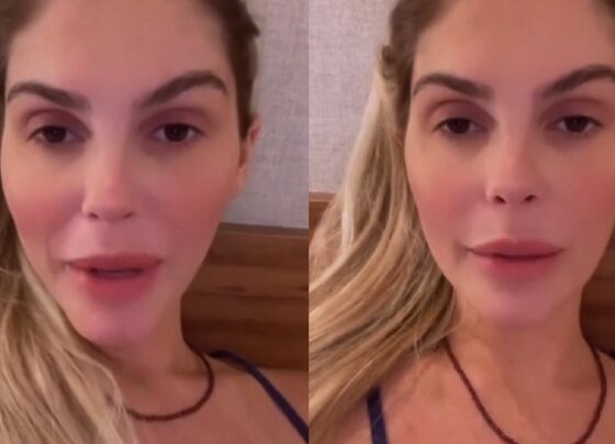 barbara-evans-relata-cirurgia-de-hemorroidas-apos-casamento:-“doi-demais”