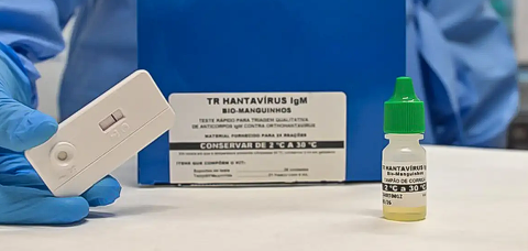Novo teste faz diagnóstico de hantavirose em 20 minutos